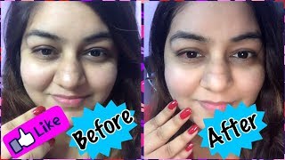 Watch DIY Natural Homemade Moisturiser | Dry & Oily Skin | How to Get Glowing Skin Video