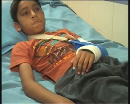 Watch Ahmedabad Student fractures hand after teacher beats him Video