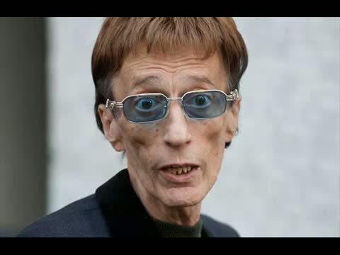Watch Robin Gibb of the Bee Gees Hospitalized for Intestinal Surgery Video