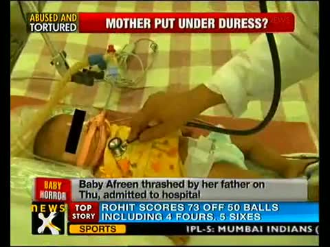 Watch Battered baby Aafreen on life support system Video