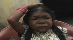 Watch Plight and misery of 36 inch girl Video