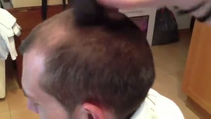Watch If You Are Bald You Need This Video