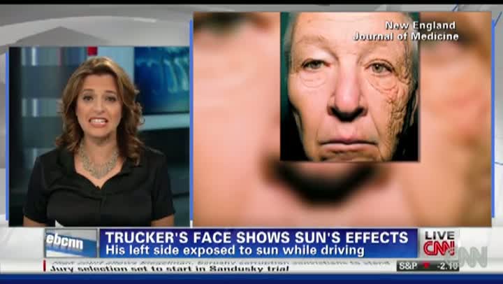 Watch Trucker Says Sun Did THIS To His Face Video