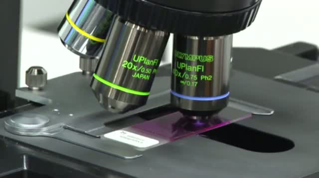 Watch Designing People: Babies With DNA From 3 People?. Video