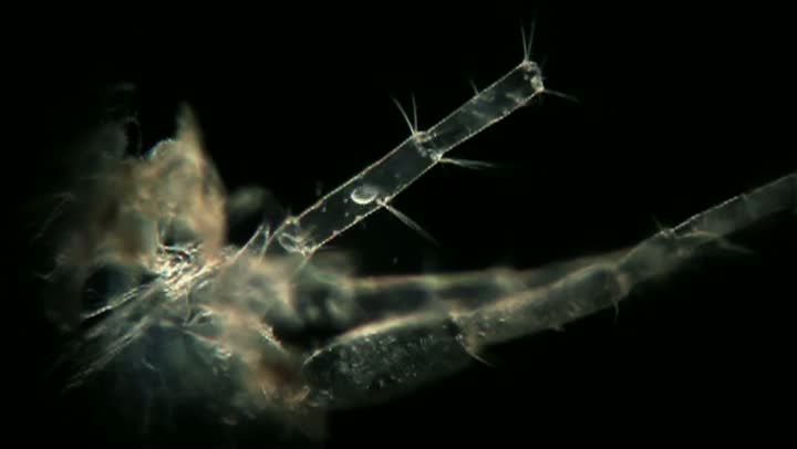 Watch What Could Be Hidden In The Tap Water You Drink Video