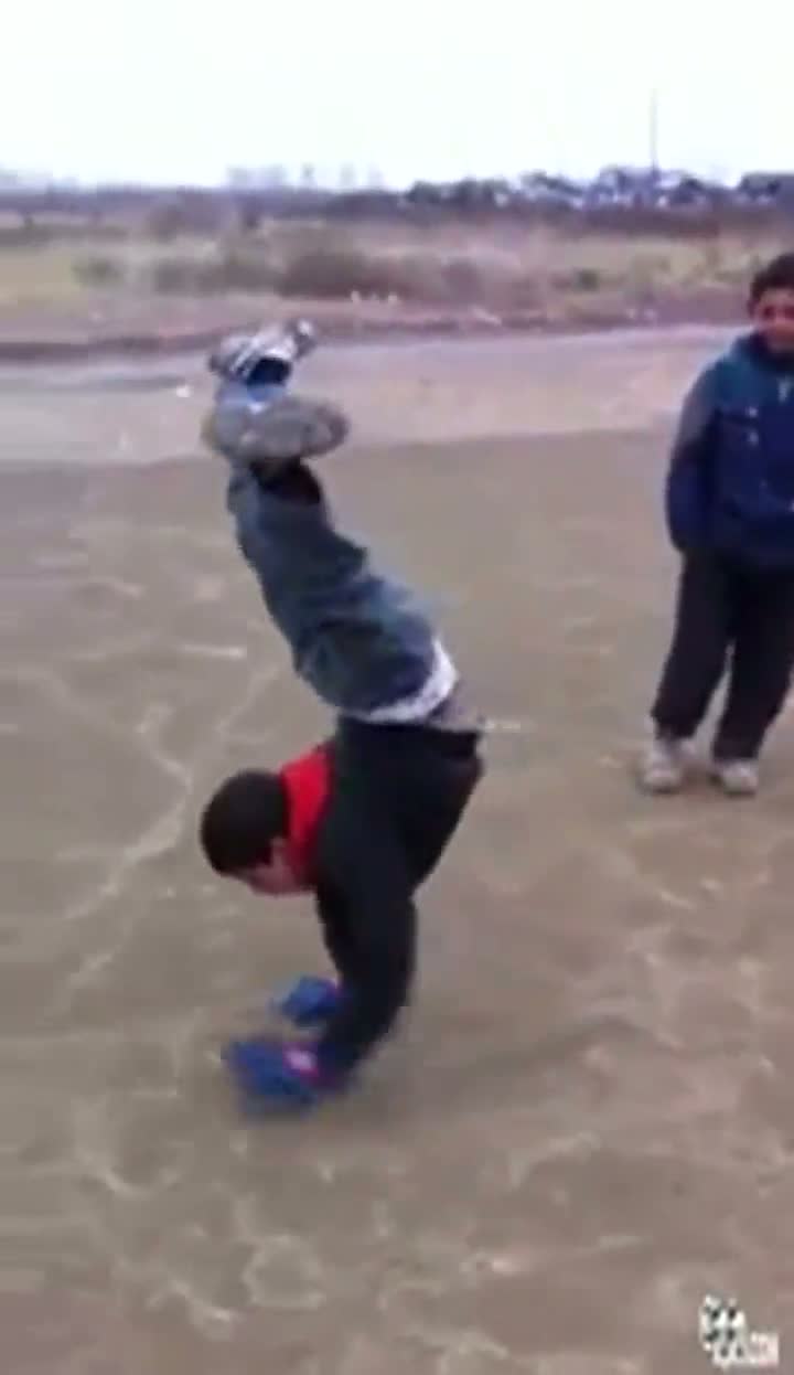 Watch Kid With Inverted Knees... Video