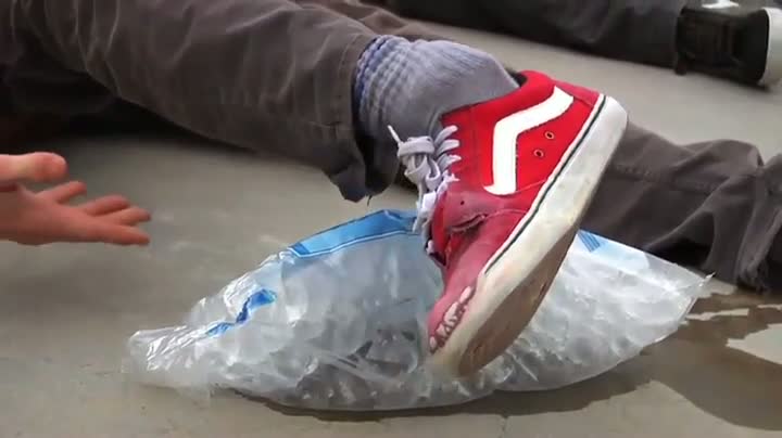 Watch Skateboarder Suffers Horrific Injury Video