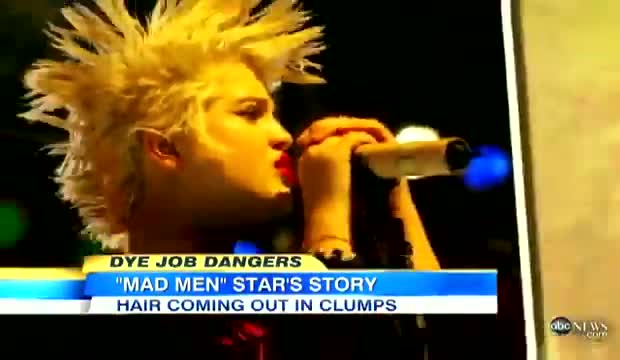 Watch Actress Hair Falling Out Video