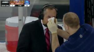 Watch John Giannone Takes A Puck To The Face Video
