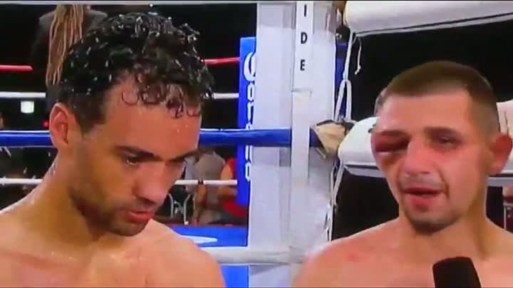 Watch Pawel Wolak's Unforgettable Shiner Against Delvin Rodriguez Video