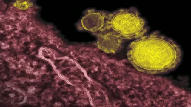Watch Fauci: New Virus Not Yet a 'threat to the world' Video