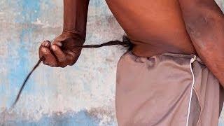 Watch The Man With A 14.5 Inch Tail Video