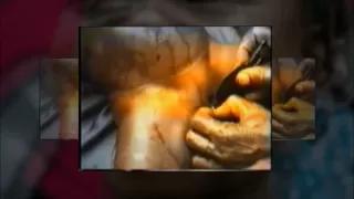 Watch What Female Genital Mutilation does to Little Girls Video