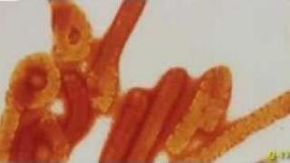 Watch Ebola Virus Pandemic Liberia Shuts Down Its Borders Video