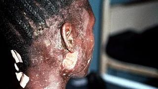Watch The Ebola Virus Will Kill You Video