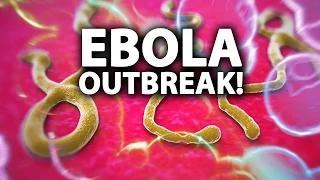 Watch RANT: The Ebola Outbreak Will Kill Us All! Video