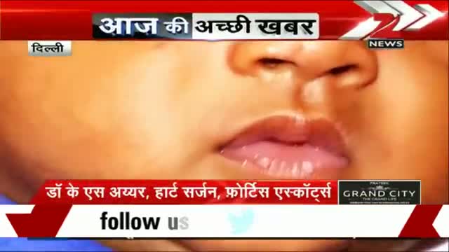 Watch Delhi doctors conduct open heart surgery on 18-hour-old baby Video