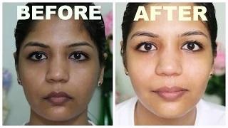Watch IMMEDIATE SKIN LIGHTENING - How To Use Bleach For Skin Lightening Video