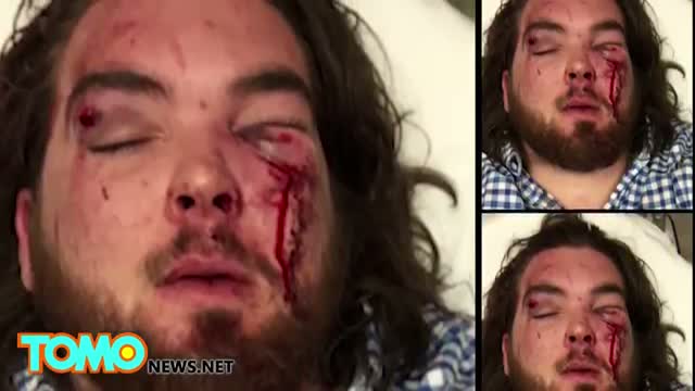 Watch Sucker punch: Kentucky QB Drew Barker demolished by EKU's Patrick Graffree Video