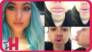Watch Kylie Jenner Lip Challenge Is Out of Control! Video
