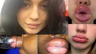 Watch Kylie Jenner Lip Challenge WTF Video