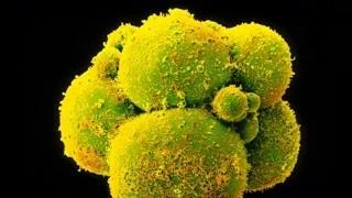 Watch Genetically modified human embryos: Chinese scientists raise concerns after editing embryo DNA Video