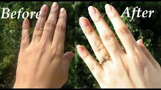 Watch How to Remove Sun Tan From Your Body Instantly Video