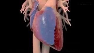 Watch How Heart Attack Occurs Video