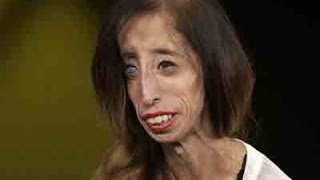 Watch Lizzie Velasquez Talks Strength and Bullying Video