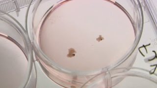 Watch Researchers Grow Brain Parts to Study Disease Video