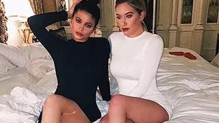 Watch Kylie Jenner Flaunts Leg Scar & Reveals How She Got It Video