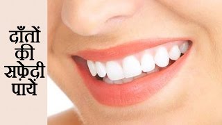 Watch How To Whiten Teeth At Home Naturally (Hindi) Video