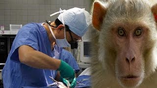 Watch Monkey head transplant done first time in history, surgeon claims successful Video