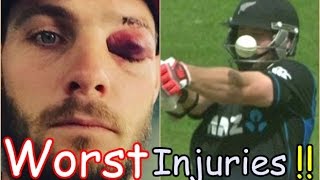Watch WORST CRICKET INJURIES IN CRICKET HISTORY EVER ! Video