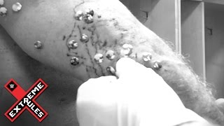 Watch Chris Jericho gets tacks removed from his body after Extreme Rules: May 23, 2016 Video