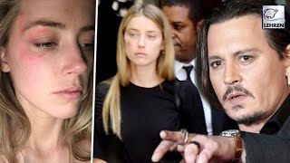 Watch Bruised Amber Heard ACCUSED Johnny Depp Of Domestic Violence Video