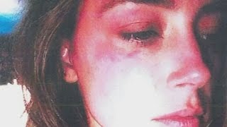 Watch Johnny Depp's wife Amber Heard accuses him of assault Video