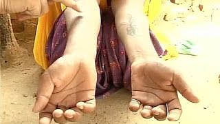 Watch Rajasthan man inscribes tattoo abuses on wife's body Video
