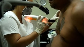 Watch Ex-gang members in El Salvador seek riddance of their tattoos Video