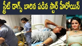 Watch à°¸à±à°Ÿà±à°°à±€à°Ÿà± à°¡à°¾à°—à±à°¸à± à°¬à°¾à°°à°¿à°¨ à°ªà°¡à°¿à°¨  à°¹à±€à°°à±‹à°¯à°¿à°¨à± : Parul Yadav Hospitalised After Being Bitten By Stray Dogs : Video