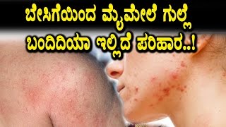 Watch Are you facing summer skin problems | Home remedy | Top Kannada Health Tips Video