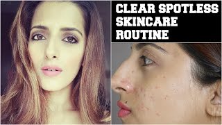 Watch #Beauty Tips For Face- How To Get Crystal Clear, Glowing, Spotless Skin / Remove Acne & Pimple Scars Video
