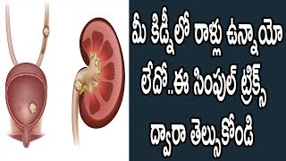 Watch à°®à±€ à°•à°¿à°¡à±à°¨à±€à°²à±‹ à°°à°¾à°³à±à°²à± à°‰à°¨à±à°¨à°¾à°¯à±‹ à°²à±‡à°¦à±‹..à°ˆ à°¸à°¿à°‚à°ªà±à°²à± à°Ÿà±à°°à°¿à°•à±à°¸à± à°¦à±à°µà°¾à°°à°¾ à°¤à±†à°²à±à°¸à±à°•à±‹à°‚à°¡à°¿|Natural Health & Cure Video