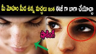 Watch Wow Very Easy way to remove black marks in your face | Health Tips | Natural Health & Cure | Health Video