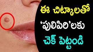 Watch How to Get Rid of Skin Moles at Home Naturally|Natural Health & Cure Video