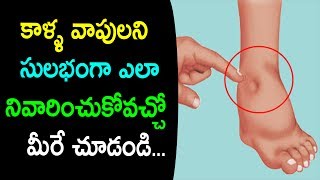Watch What Causes Water Retention (Edema) and How to Avoid It | Swelling from legs | Natural Health & Cure Video