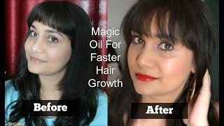 Watch 100% Result | How to Grow hair Fast at home | Stop Hairfall Completely Naturally | Nidhi Katiyar Video