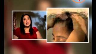 Watch Benefits of Coconut for a Healthy Life- Gunjan (Beauty Expert) Aapka Beauty Parlour Video