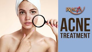 Watch SKIN TIPS! ACNE Treatment- Dr. Vibha Sharma (Ayurveda & Panchkarma Expert) Video