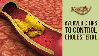 Watch Ayurvedic Tips To Control Your Cholesterol - Dr. Vibha Sharma (Ayurveda & Panchkarma Expert) Video